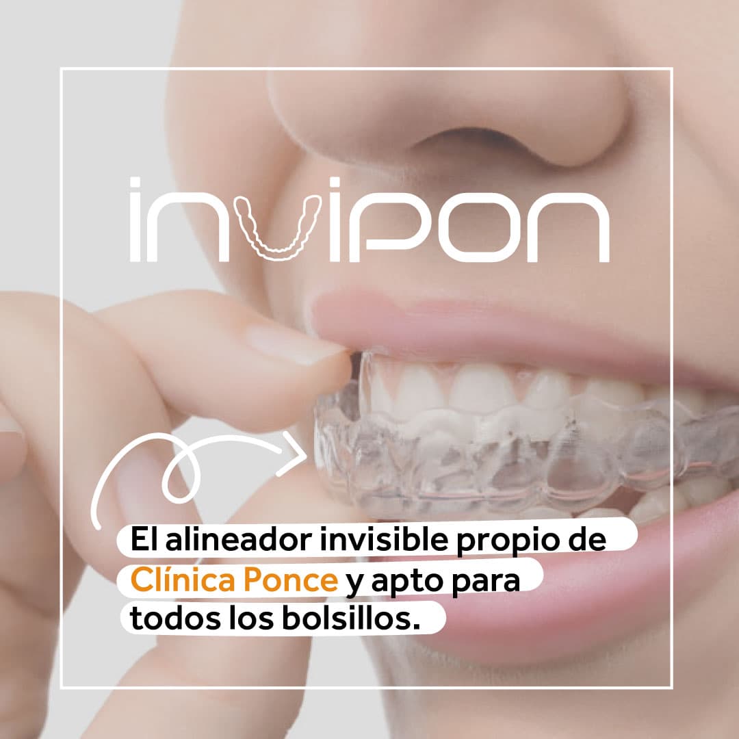 INVIPON, el alineador invisible propio de Clínica Ponce de León